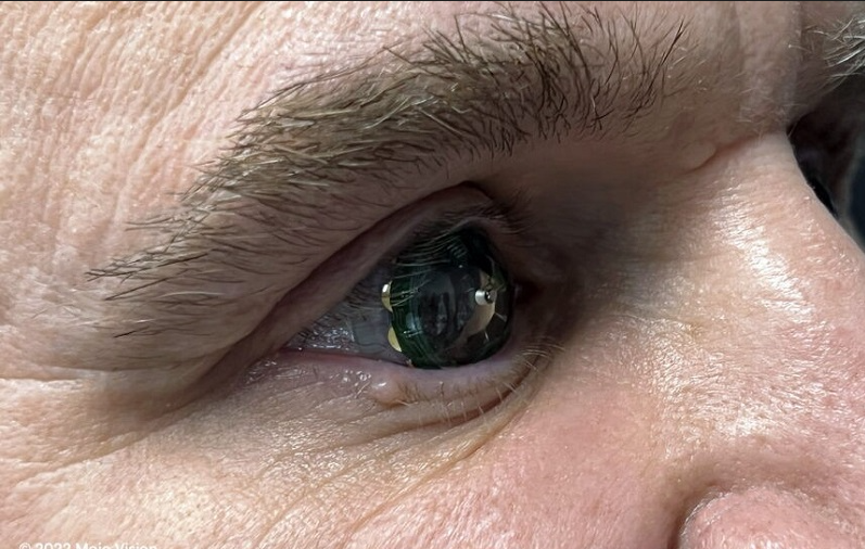 AR隐形眼镜厂商Mojo Vision将专注于MicroLED开发