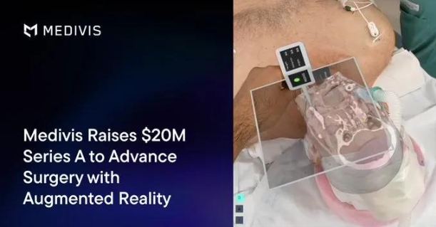 AR医疗技术公司Medivis完成2000万美元A轮融资